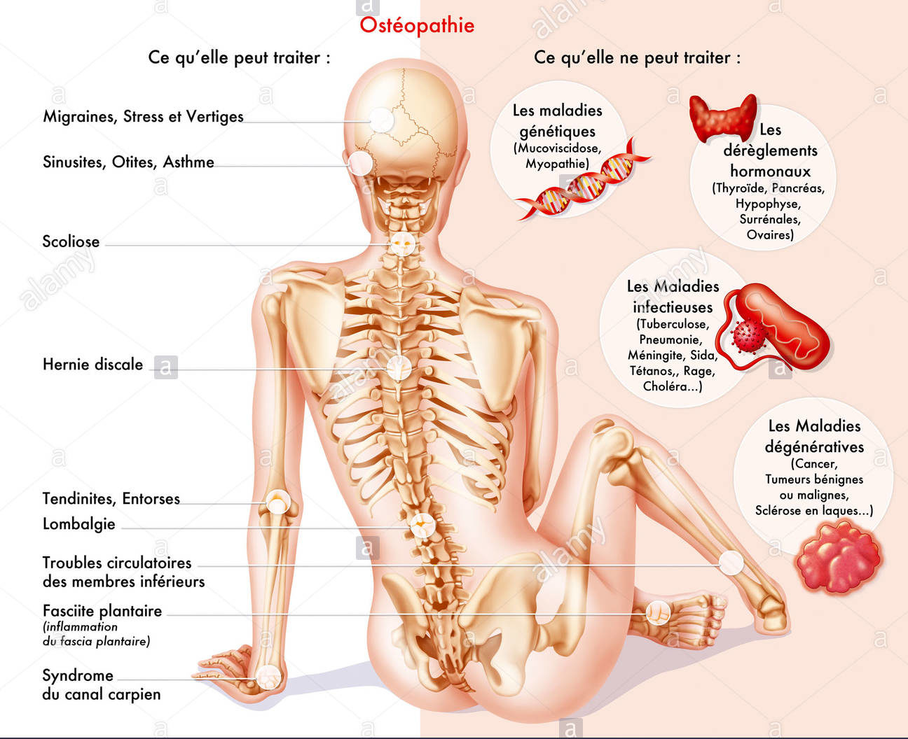 The Benefits of Osteopathy Treatment