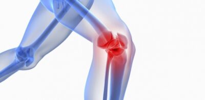 Everythings about Chronic Knee Pain
